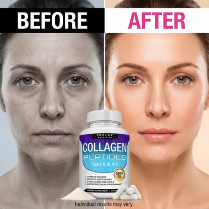 Collagen Peptides 5 Types Complex 1800mg US Made Dietary Supplement for Health Beauty Fitness 90 Capsules